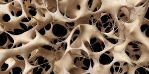 osteoporoza pregled